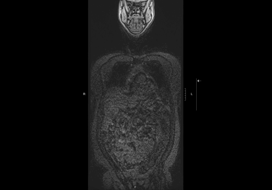 MRI Animated GIF file